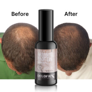 Delofil Hair Growth Oil - Anti Hair Loss Treatment with Argan Oil, Keratin & Biotin for Men and Women